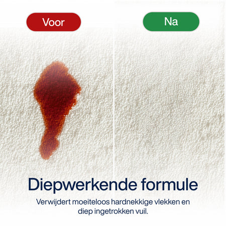 Vlekverwijderaar Solution Spray